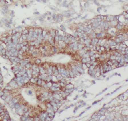 CKB-Specific antibody|CKB抗体