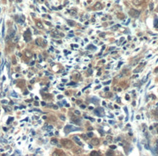 RNF125 antibody|RNF125抗体