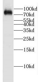 CPEB4 antibody|CPEB4抗体