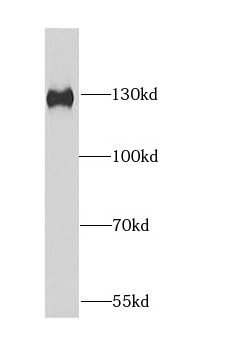 DDB1 antibody|DDB1抗体 FNab02284
