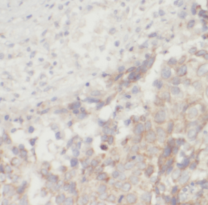 FGF8 antibody|FGF8抗体