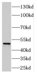 ENO3 antibody|ENO3抗体 FNab02766