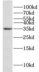 ENOPH1 antibody|ENOPH1抗体 FNab0