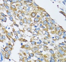 SLC25A13 antibody|SLC25A13抗体