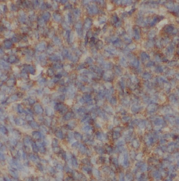 APOH antibody|APOH抗体 FNab00510