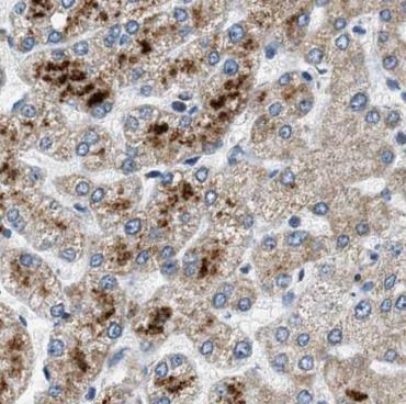 STX17 antibody|STX17抗体