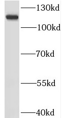 RNF20 antibody|RNF20抗体