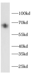 IRAK3 antibody|IRAK3抗体 FNab108