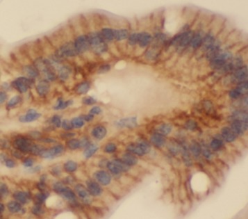 RAC1 antibody|RAC1抗体 FNab07064