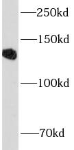 CD22 antibody|CD22抗体 FNab10004