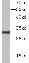 KLRC1 antibody|KLRC1抗体
