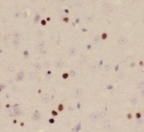 TKT antibody|TKT抗体 FNab08938