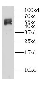 DEPTOR antibody|DEPTOR抗体 FNab0