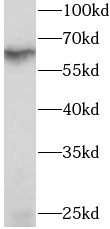 RIOK3 antibody|RIOK3抗体