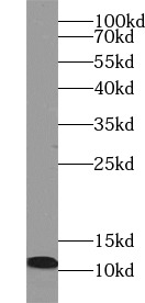 S100A8 antibody|S100A8抗体 FNab0