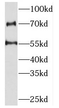 PKNOX2 antibody|PKNOX2抗体
