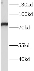 ITFG1 antibody|ITFG1抗体 FNab044