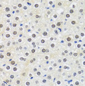 MTAP antibody|MTAP抗体