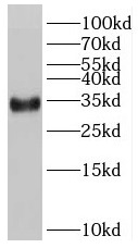 RSPO2 antibody|RSPO2抗体