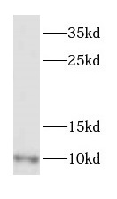 DYNLL2 antibody|DYNLL2抗体