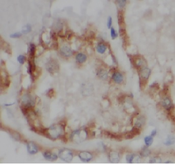 VDAC2 antibody|VDAC2抗体 FNab093