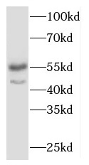 MAPK10 antibody|MAPK10抗体