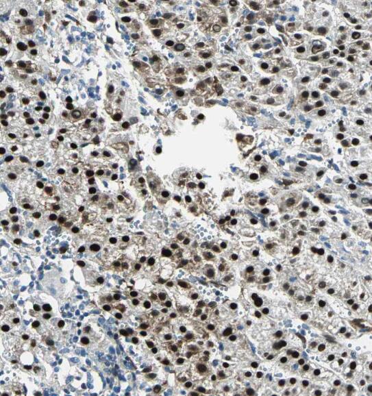 RPL7L1 antibody|RPL7L1抗体