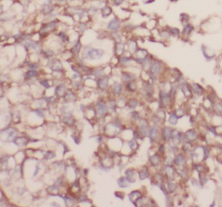 FLT1 antibody|FLT1抗体