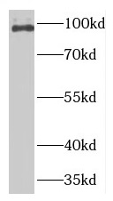 TNPO2 antibody|TNPO2抗体