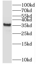 TSPAN10 antibody|TSPAN10抗体