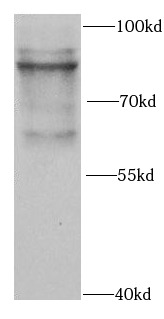 PML antibody|PML抗体