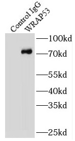 UBE2T antibody|UBE2T抗体