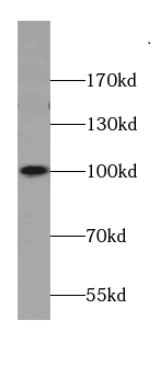 AKAP3 antibody|AKAP3抗体 FNab002