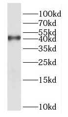 DUSP9 antibody|DUSP9抗体 FNab025