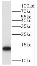 POLR2J antibody|POLR2J抗体