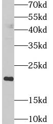 PPIC antibody|PPIC抗体 FNab09981