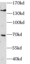 ZBTB11 antibody|ZBTB11抗体