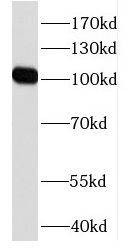 DZIP1 antibody|DZIP1抗体