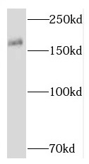 RNF17 antibody|RNF17抗体