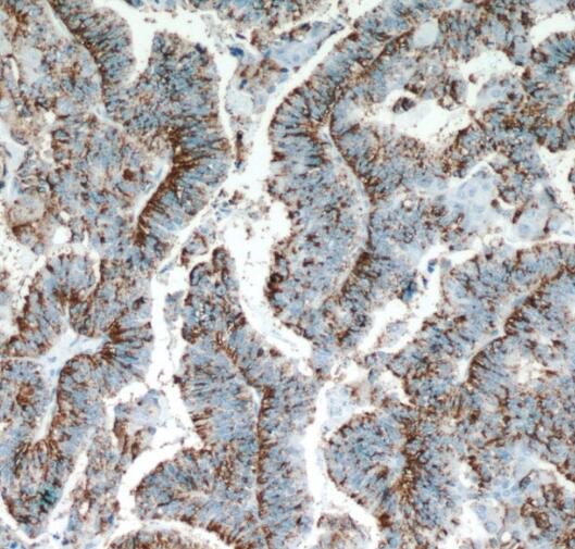 SERPINA5 antibody|SERPINA5抗体 F
