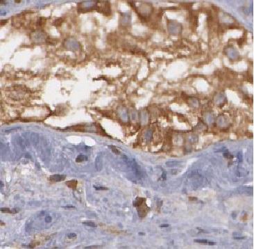 ARL3 antibody|ARL3抗体