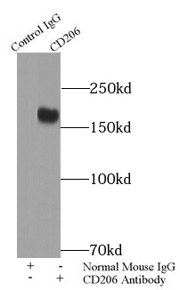 WAS antibody|WAS抗体