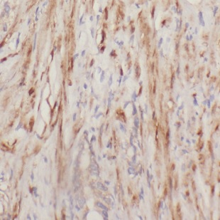 DOK4 antibody|DOK4抗体