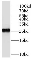 ROPN1L antibody|ROPN1L抗体