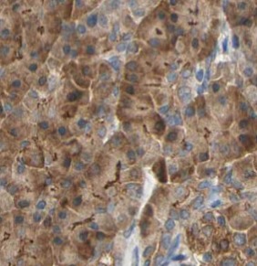 NQO1 antibody|NQO1抗体