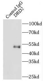 KRT18 antibody|KRT18抗体 FNab022