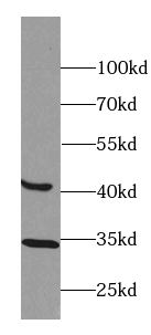 BTBD8 antibody|BTBD8抗体