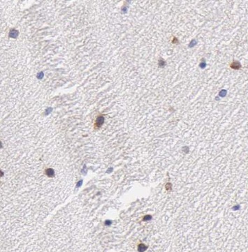 OAS3 antibody|OAS3抗体