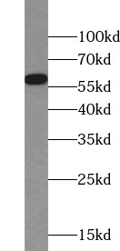 MPO antibody|MPO抗体 FNab05285