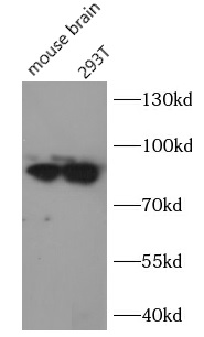 TLE1 antibody|TLE1抗体 FNab08719